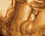 4 Dimenziós ultrahang vizsgálat - babamozi